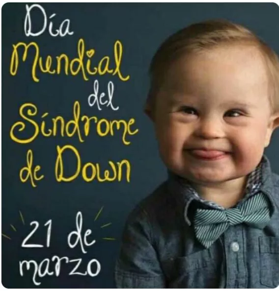 sindrome-down
